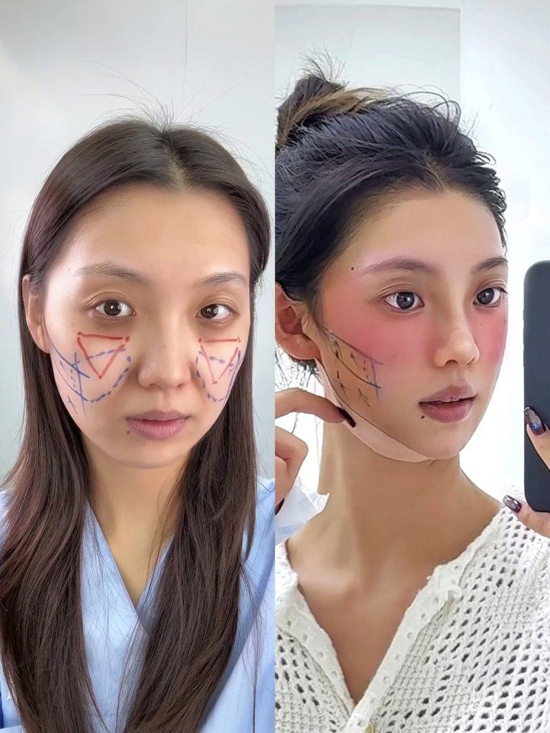二、东莞壹加壹整形美容医院口碑怎么样?真实实例告诉你答案!www.fakemusicmedia.com/