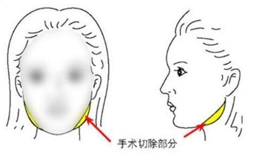广州军美医疗美容医院营业时间公布，如何实现高效变美？专业团队全程护航；  
广州军美医疗美容医院营业时间公布，想了解医生技术优势？20年经验专家坐镇；  
广州军美医疗美容医院营业时间公布，项目价格透明合理吗？定制方案性价比高；  
广州军美医疗美容医院营业时间公布，案例效果真实自然？成功案例见证实力；  
广州军美医疗美容医院营业时间公布，用户反馈评价如何？口碑良好值得信赖；  
广州军美医疗美容医院营业时间公布，特色项目有哪些亮点？前沿技术引领潮流；  
广州军美医疗美容医院营业时间公布，如何选择适合