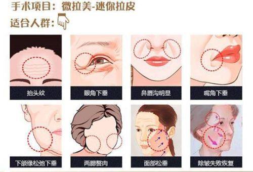 广州军美医疗美容医院口碑怎么样?真实实例反馈优质服务贴心打造满意蜕变www.fakemusicmedia.com/