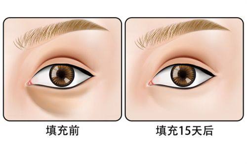 二、广州军美医疗美容医院口碑怎么样？（真实实例分享，成效令人满意）www.fakemusicmedia.com/