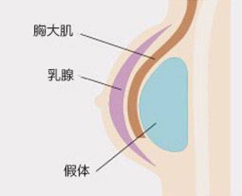 一、济南诺德医疗美容医院吸脂怎么样?微创技术让塑形更自然www.fakemusicmedia.com/