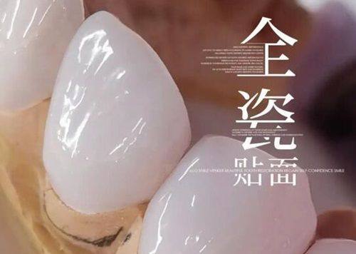 二、贺州看牙哪里技术好口碑佳
