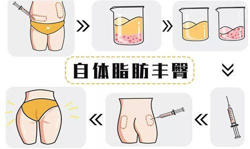 二、深圳富华医疗美容医院预约方式有哪些？在线预约和电话预约都特别方便哦www.fakemusicmedia.com/