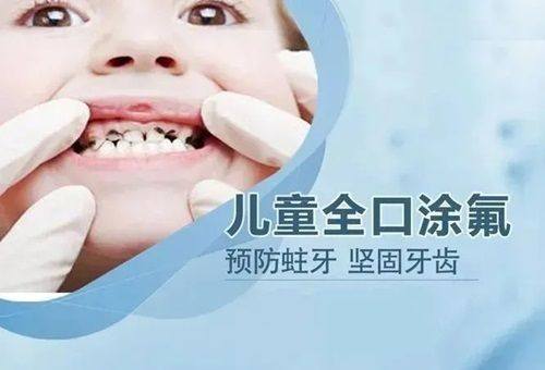 二、柳州看牙价格透明吗