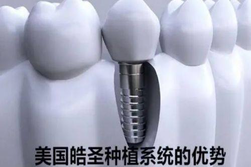 三、贺州看牙透明消费避坑指南