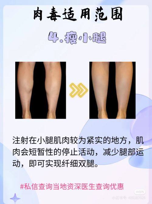 郑州美时美刻医疗美容门诊部哪个医生做得好？院内王牌技术精细眼部整形自然灵动获好评