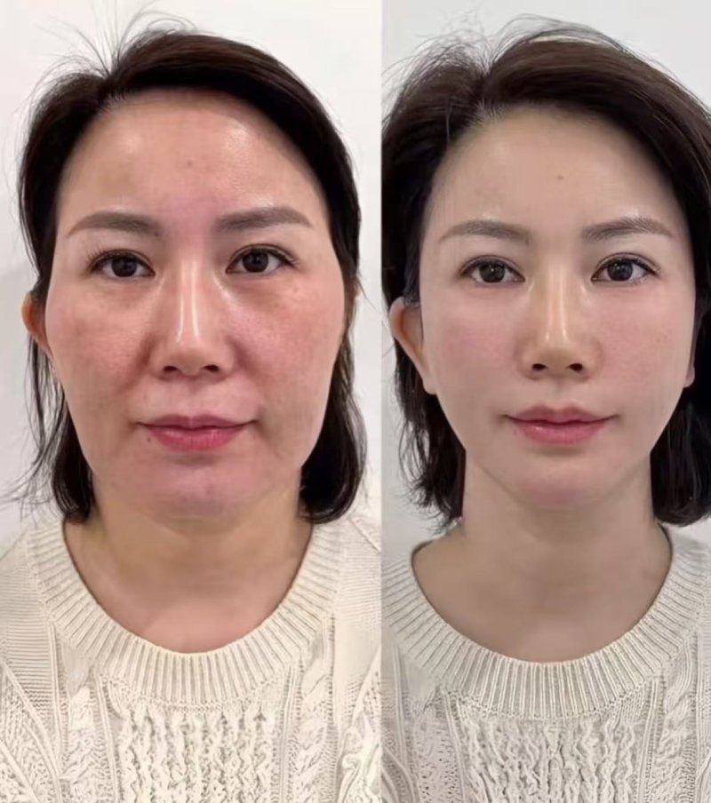 二、郑州美时美刻医疗美容门诊部服务体验如何？贴心服务赢得顾客信赖www.fakemusicmedia.com/