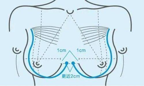 一、重庆军科疤痕中 心吸脂怎么样？www.fakemusicmedia.com/