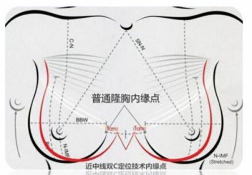 一、深圳安美聚光医疗美容诊所可靠吗？技术实力与专精团队是核心保护www.fakemusicmedia.com/