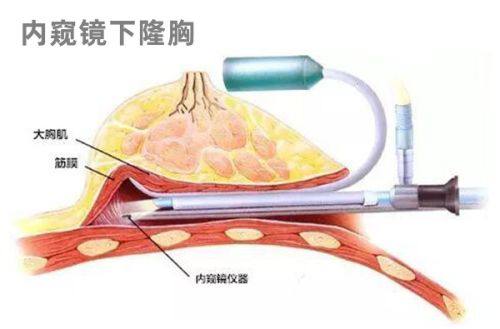 一、珠海韩妃医疗美容门诊部技术好吗？显微镜下精细操作，成效自然持久www.fakemusicmedia.com/