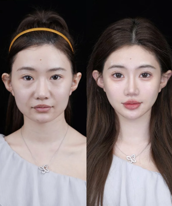 总结：珠海韩妃医疗美容门诊部技术好吗？综上所述，这家医院值得信赖！www.fakemusicmedia.com/