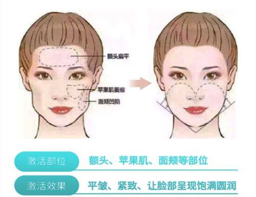 一、2026 长沙暑假双眼皮价格表|学生全切埋线收费明细?www.fakemusicmedia.com/