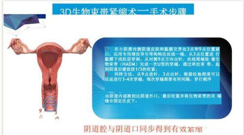 二、兰州时光整形美容医院隆鼻价格贵吗?透明收费无隐形消费,性价比极高www.fakemusicmedia.com/