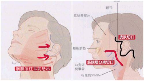 二、兰州时光整形美容医院口碑怎么样?真实实例见证蜕变,顾客好评如潮印证实力www.fakemusicmedia.com/