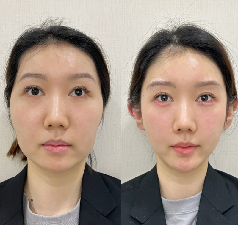 二、兰州时光整形美容医院特色项目有哪些？热门榜单揭秘自然妈生款www.fakemusicmedia.com/
