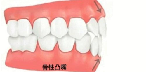 三、缺牙修复后续保护服务www.fakemusicmedia.com/