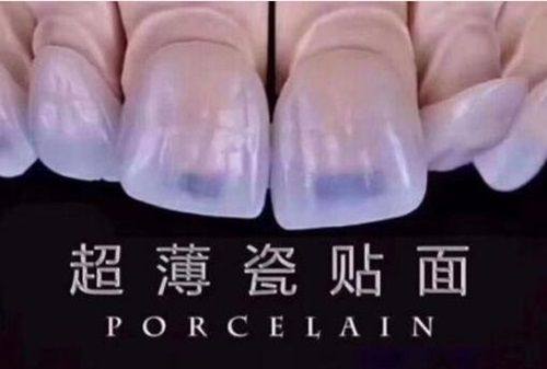 沈阳中幸口腔医院正规吗？二级专科资质认证，专家亲诊技术强且价格透明放心选