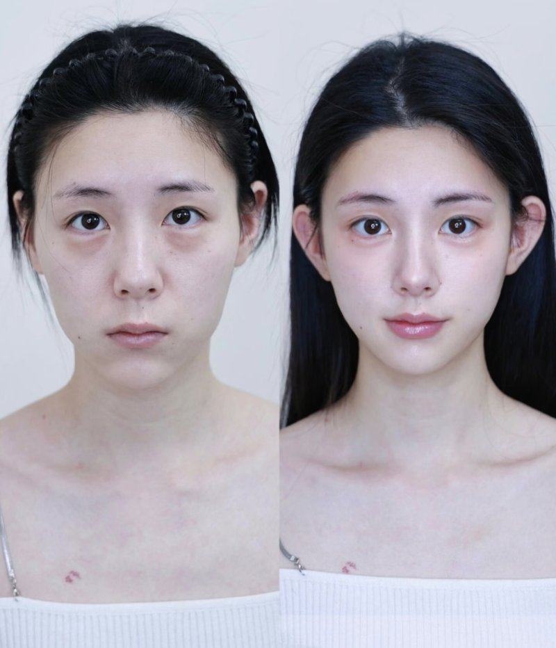 一、韩国 alive 皮肤科可靠吗？江南区认证机构技术扎实，实地探访证实实力值得信赖