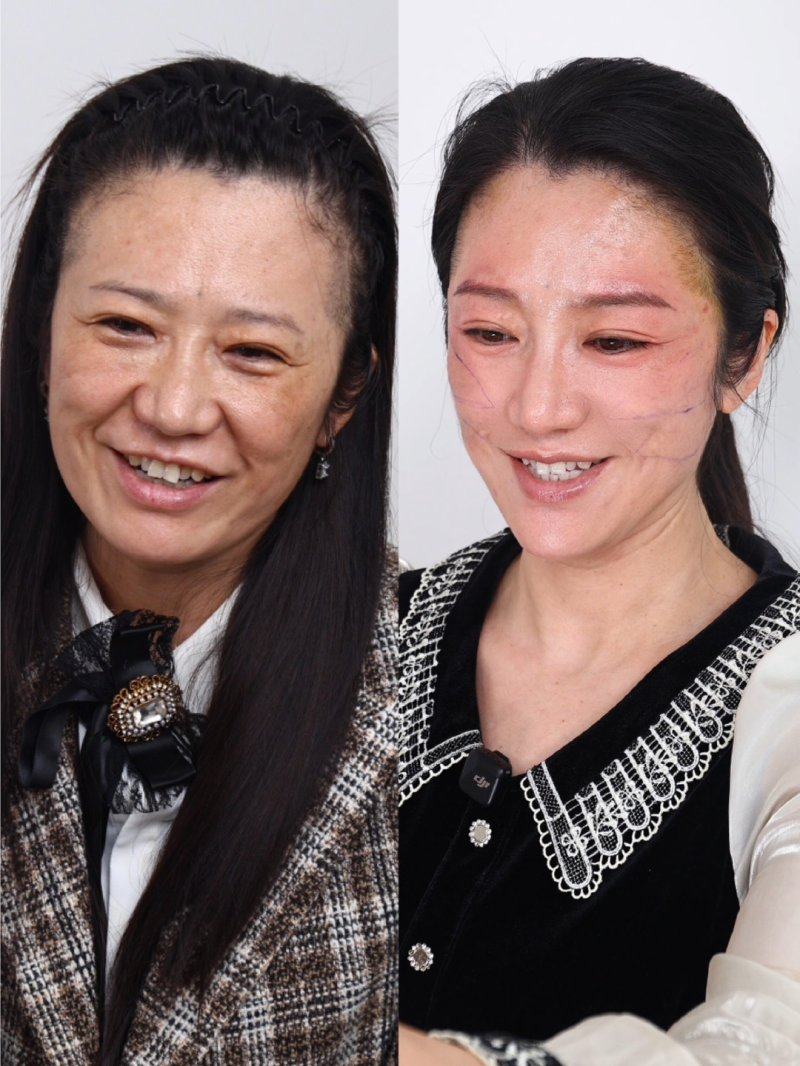 二、去韩国 Alive 皮肤科做激光美容体验如何?真实流程与服务细节大公开