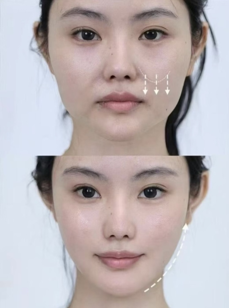 二、去韩国 Alive 皮肤科做皮肤管理需要提前多久预约？流程详解助您轻松变得更美